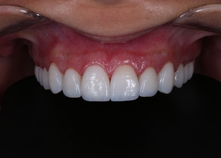 Dra. Silvia Bastos | Ortopedia Funcional dos Maxilares - foto 3