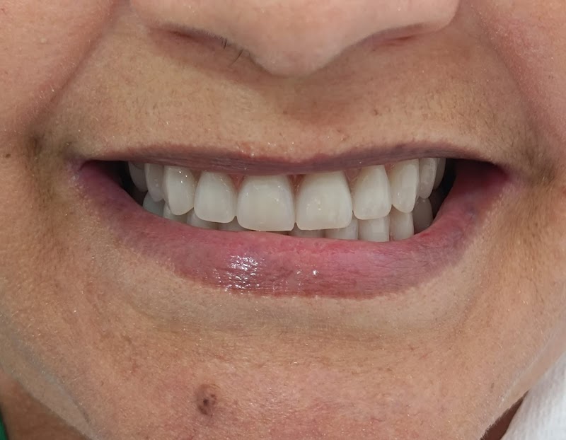 Dentista Lilian Taine Cirurgiã Dentista CRO 136094 - foto 5