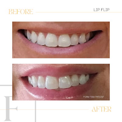 Form Total Body Wellness photo 4