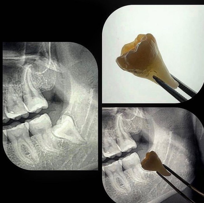 Dra Juliana Dala Rosa - foto 5