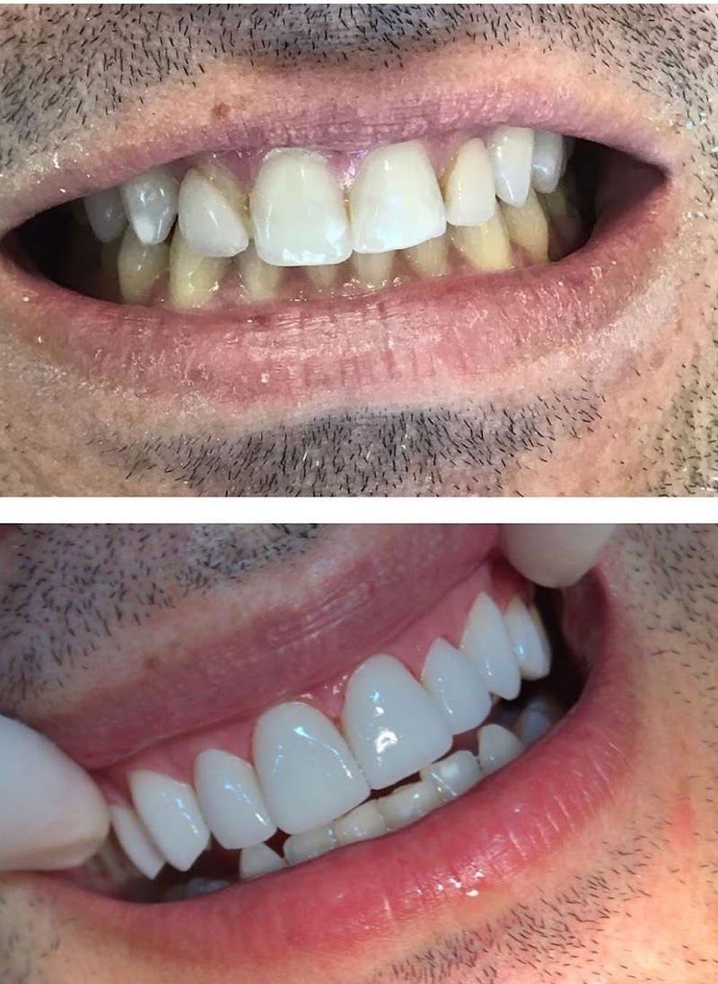 🤵DENTISTA DE URGENCIA 24HS - Dentista em Moema (BUCOMAXILOFACIAL) Implantes - Protocolo - Cirurgia Ortognática - ATM - Sisos. - foto 3