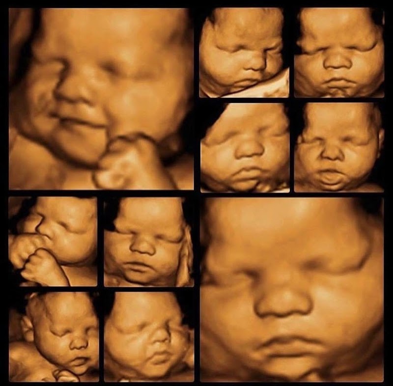 Vegas Baby! 4D Ultrasound