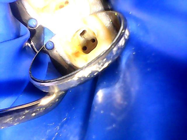 Endodontia Goiânia - Dr. Marcelo Vaz Duarte - foto 4