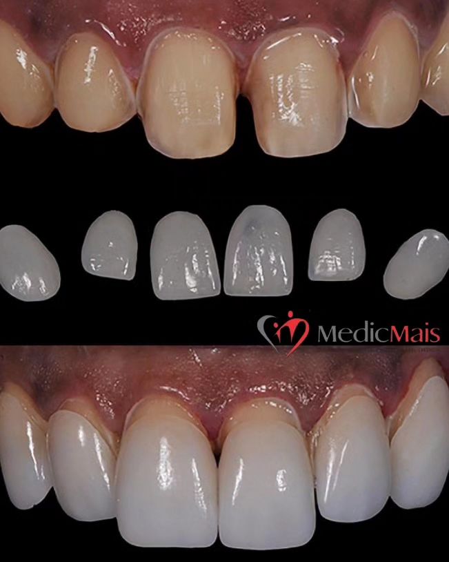 Dentista Aracaju | Clínica Odontológica MEDICMAIS ARACAJU - foto 4
