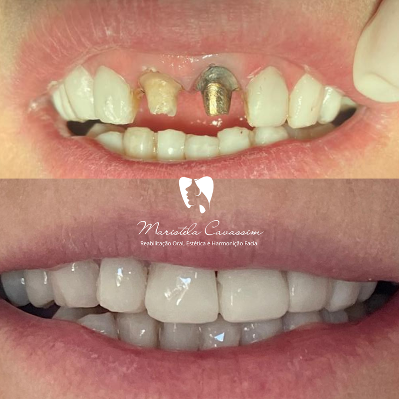 Maristela Cavassim Odontologia