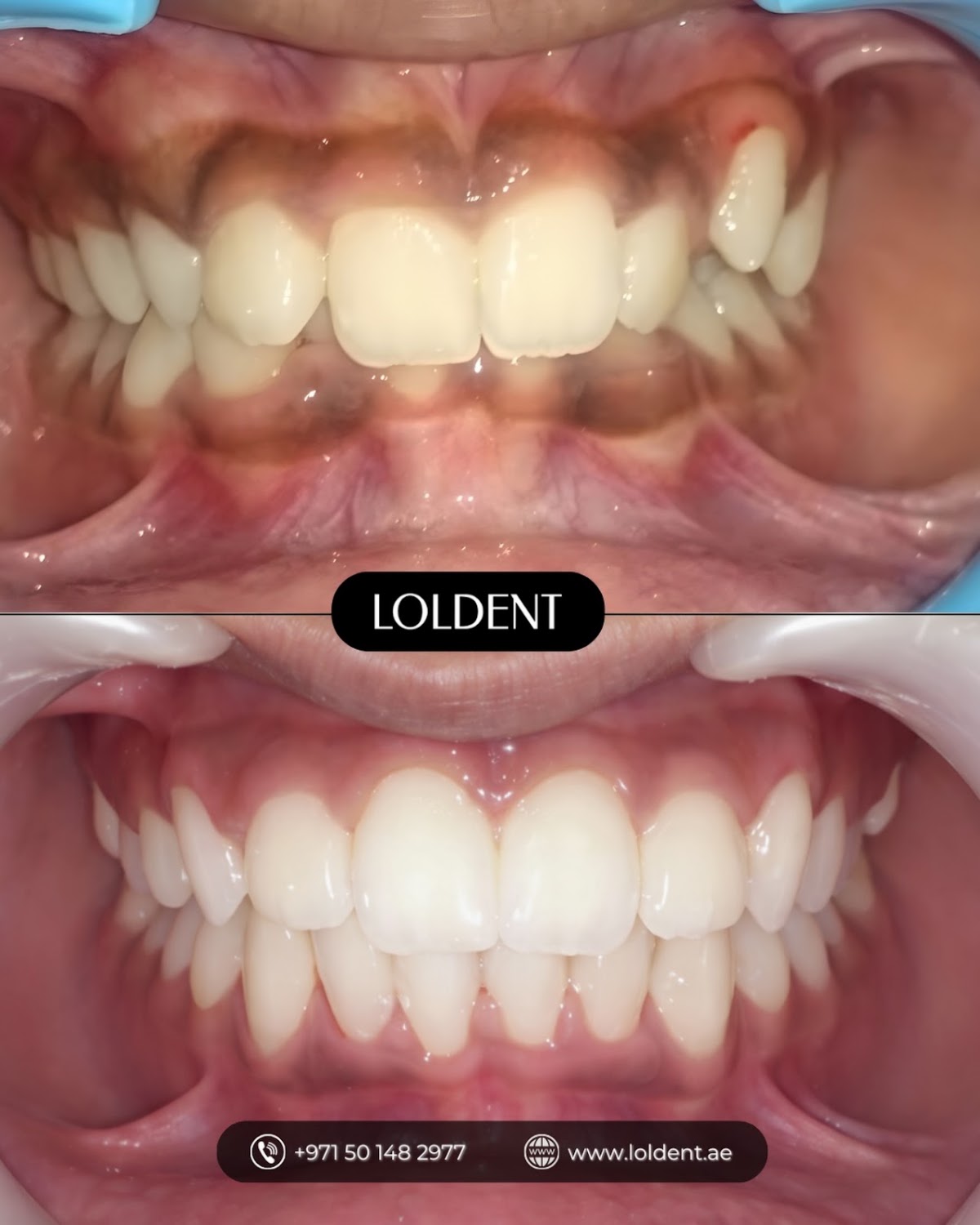 LOLDENT Dubai