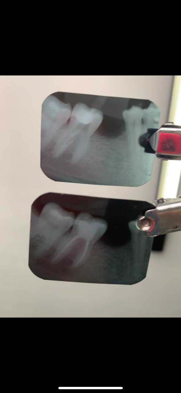 Endodontia | Rayane Garrido - foto 3