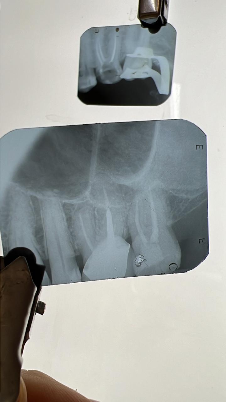 Endodontia | Rayane Garrido - foto 1