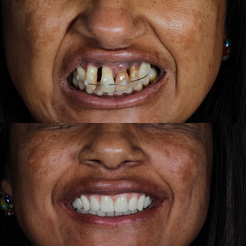 Odontovic Implantes Dentários - Campo Grande