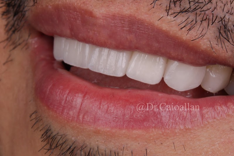 Clínica Dr. Caio Allan - foto 4