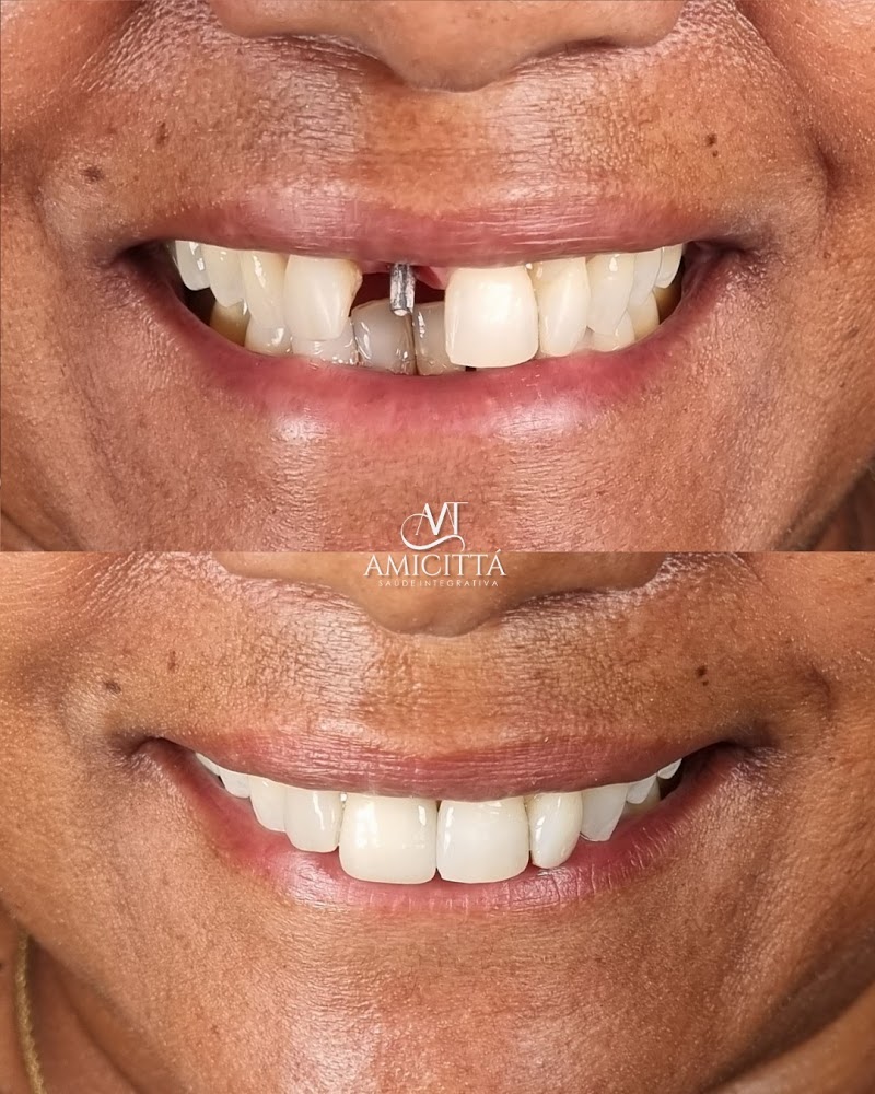 Clínica Amicittá - Odontologia e Estética no Centro RJ ( Cinelândia) - foto 5