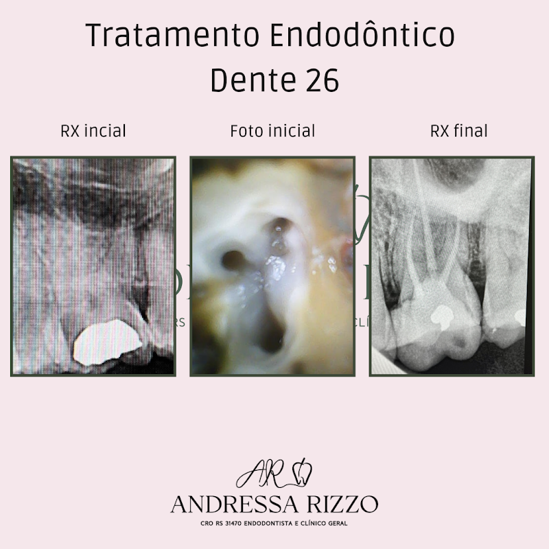 Andressa Rizzo Endodontista - foto 4