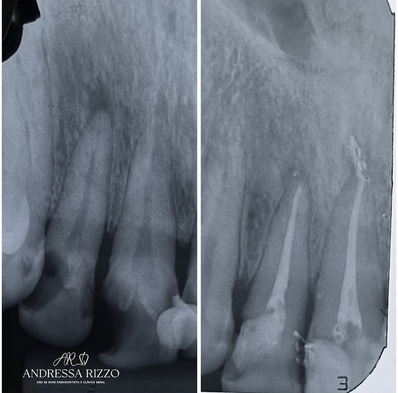 Andressa Rizzo Endodontista - foto 2