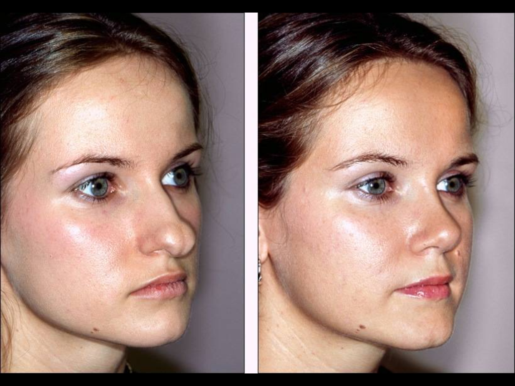 Dr Jose Jimenez Plastic Surgery and Cosmetic Medicine 5