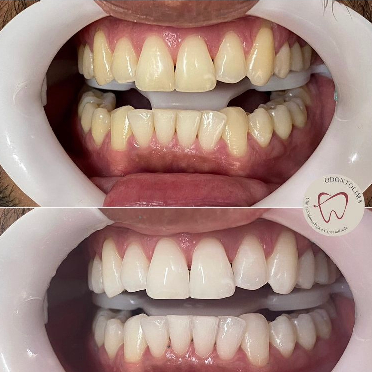 Dentista no Barreiro - Odontolima - Clínica Odontológica Especializada - foto 2