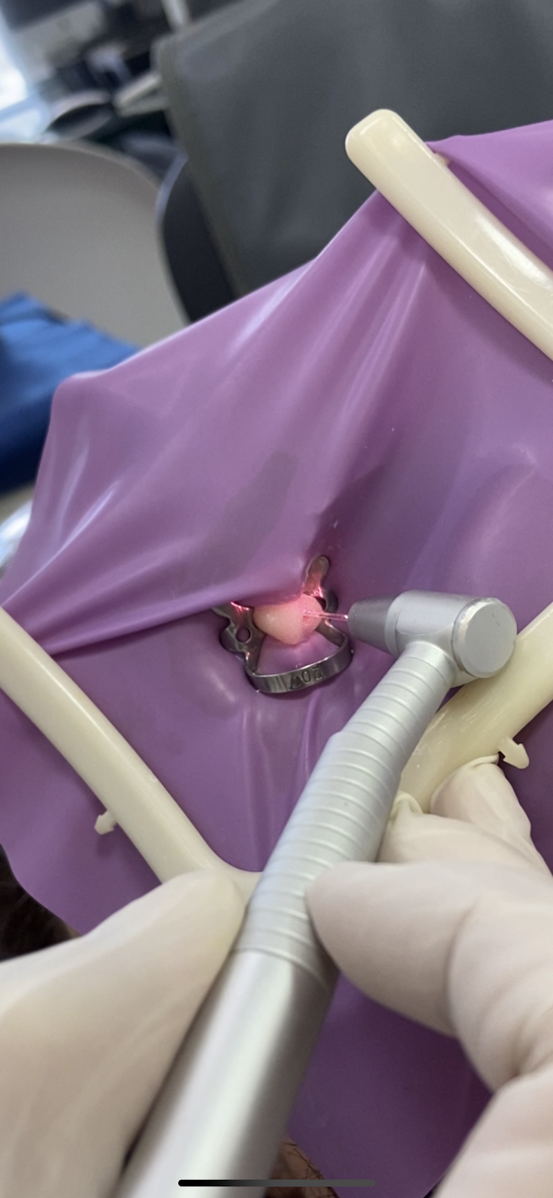 Dra. Maria Tereza Andrade Aragão - Consultório Odontológico - Endodontia / Canal com Microscópio - foto 4