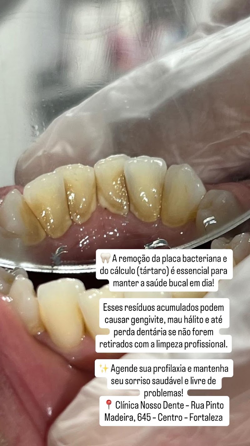 NOSSO DENTE ODONTOLOGIA ESPECIALIZADA - foto 5