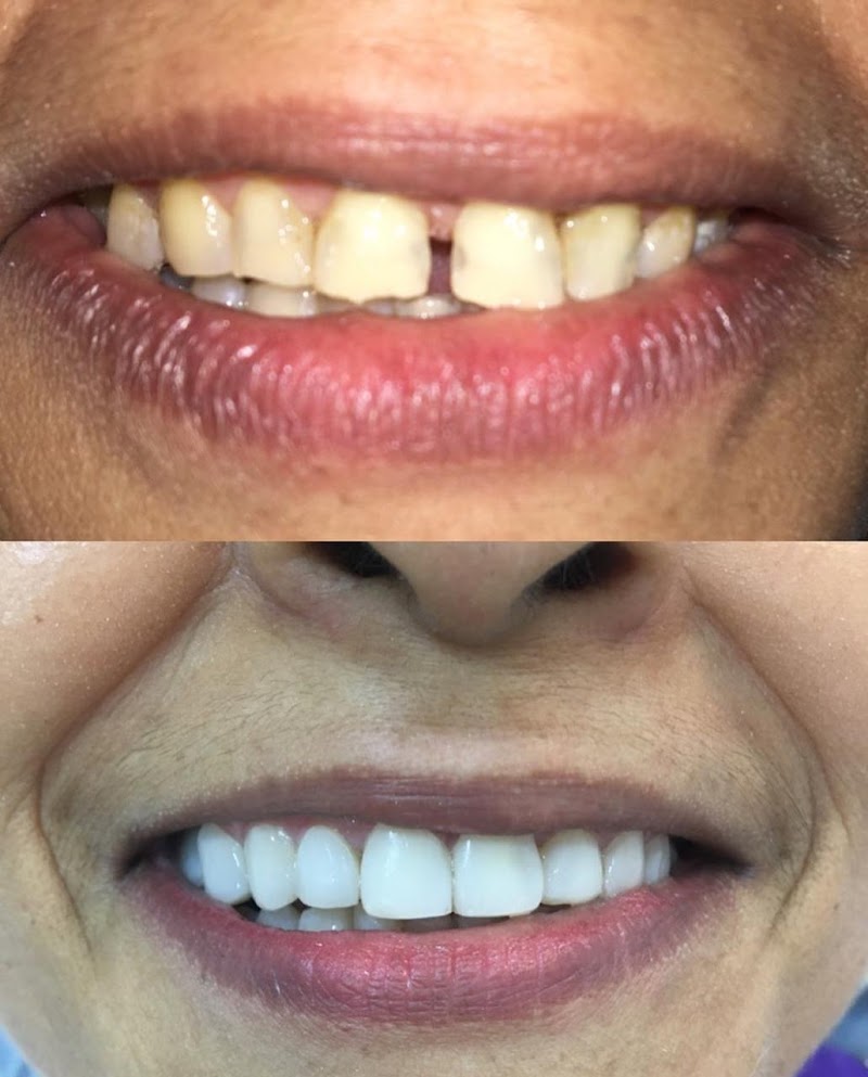 NOSSO DENTE ODONTOLOGIA ESPECIALIZADA - foto 2