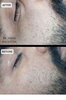 Dr. Vikas Malgotra - Image 2
