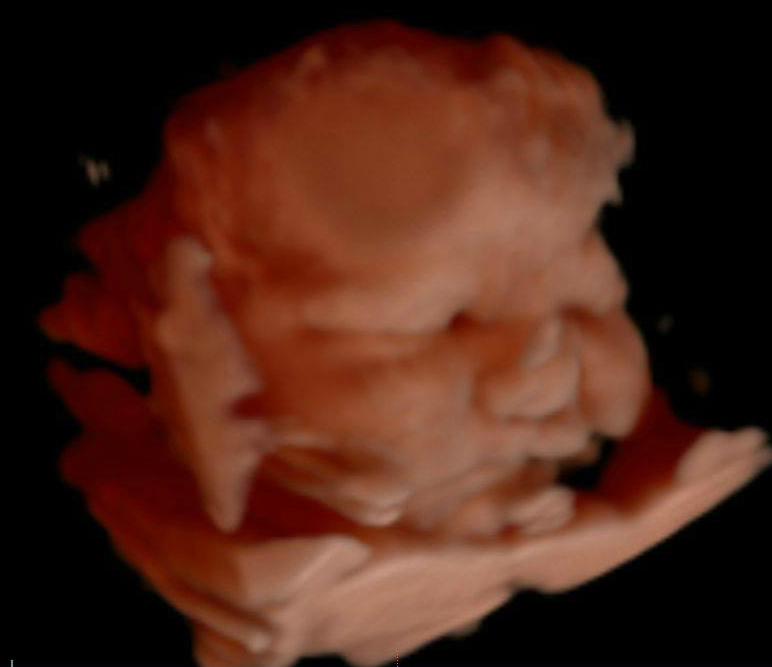 Keepsake Prenatal Imagaing 3D/4D HD Ultrasound Studio