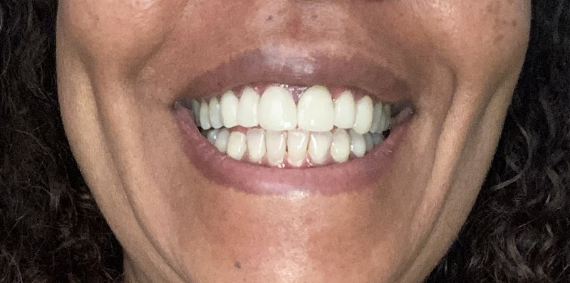 Sorridents Niterói: Dentista, Clínica Odontológica, Implantes Dentários, Aparelho - foto 4