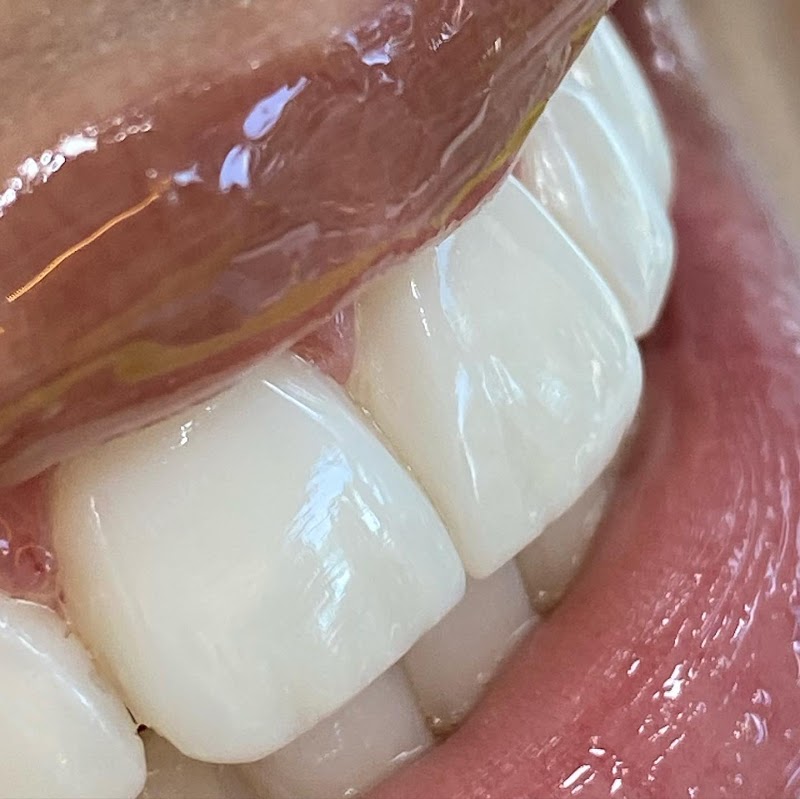 Dra Lídia Dinoah - Dentista - Facetas e Harmonização - foto 4