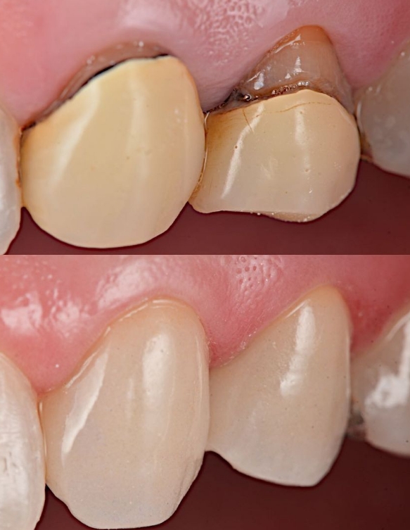 Odontologia Siqueira (Catete) - foto 5