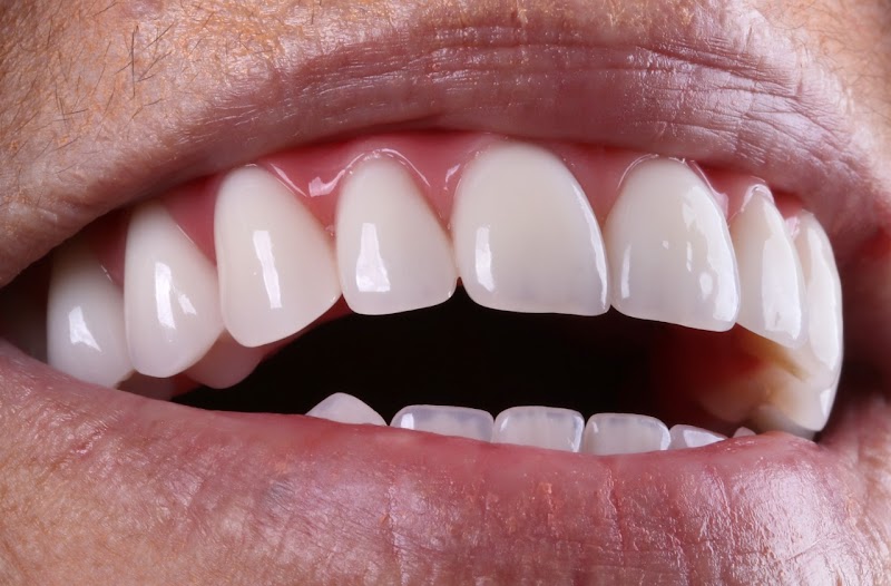 INSTITUTO KOPP ODONTOLOGIA Implante Dentário Curitiba - foto 4