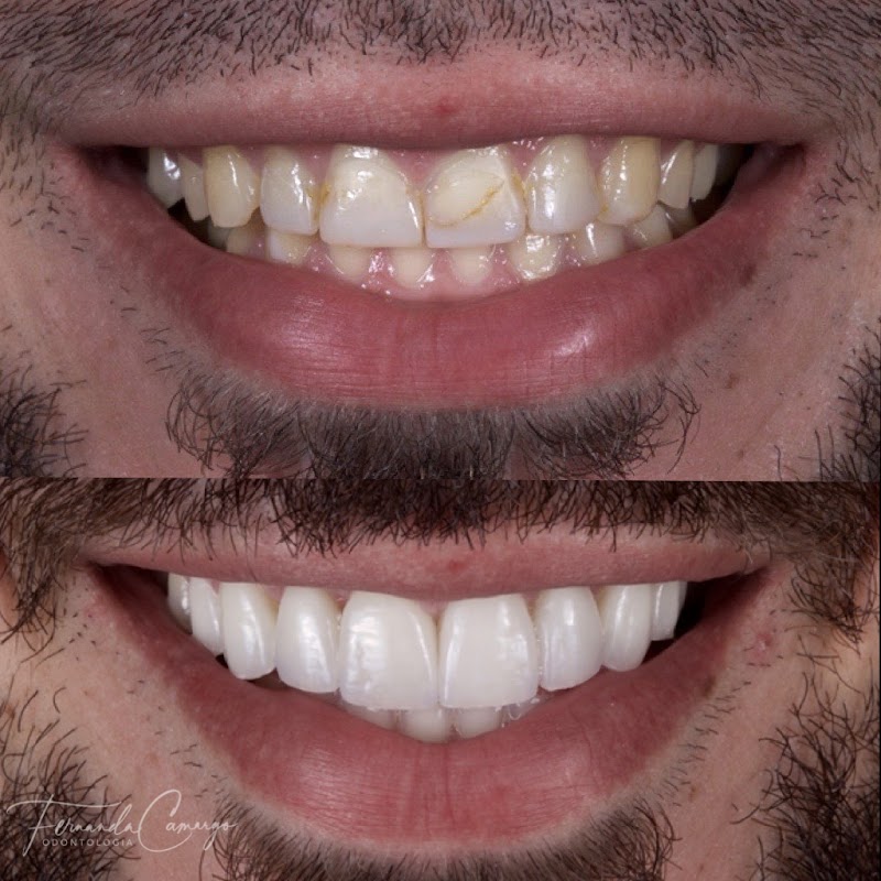 Dra Fernanda Camargo Reabilitação Oral e Estética - foto 4