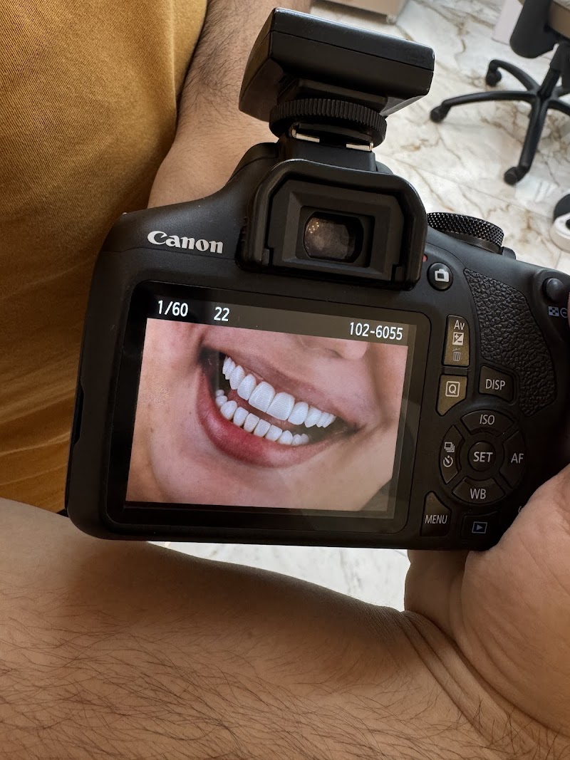 Dra. Caroline Tigre • Lentes em resina & Porcelana - foto 4