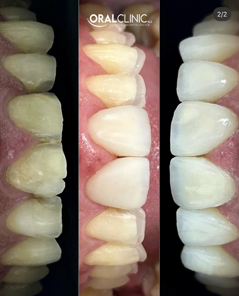 Oral Clinic Slz - foto 5