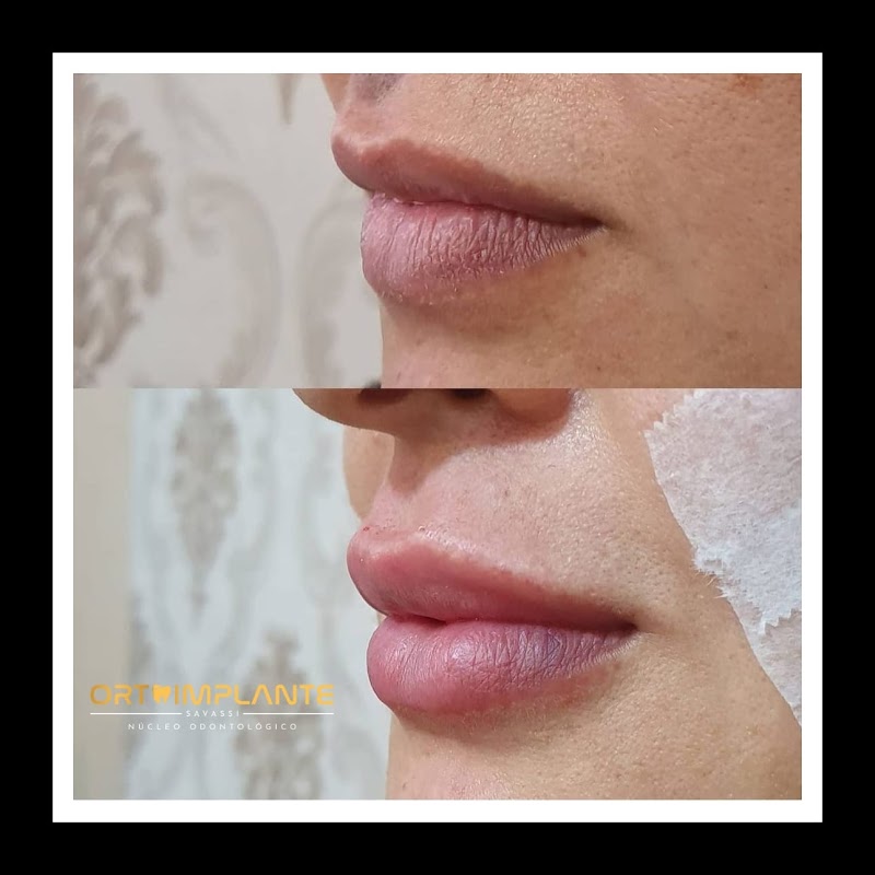 OrtoImplante Savassi - foto 5