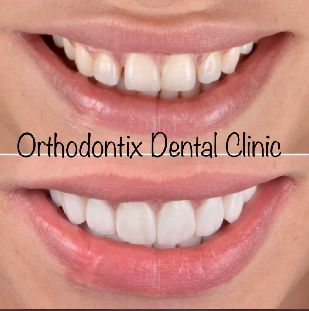 ORTHODONTIX DENTAL CLINIC - Deira Dubai 2