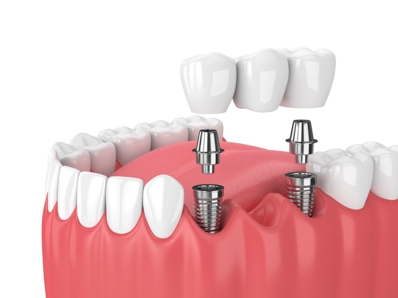 ORTHODONTIX DENTAL CLINIC - Deira Dubai 5