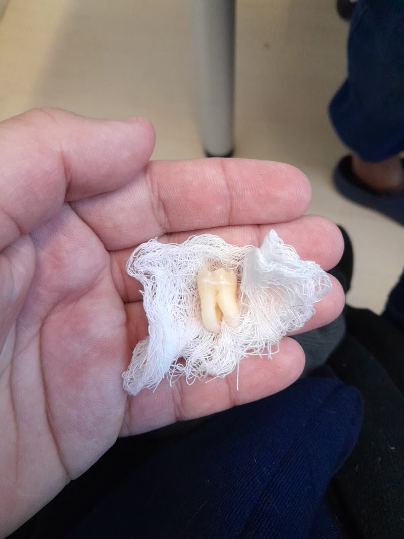 Bucomaxilofacial Angelo’s Dentista de Emergência 24 horas Aberto Recreio Rj - foto 5