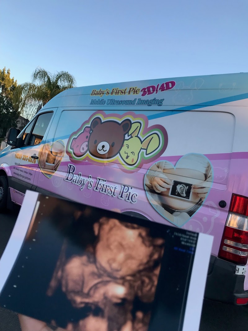 Baby's First Pic 3d4d ultrasound imaging