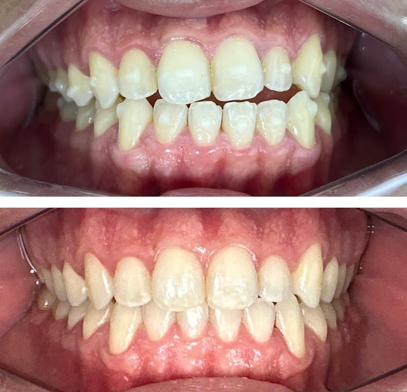 Dra. Analice Martins Ortodontia Invisalign - foto 2