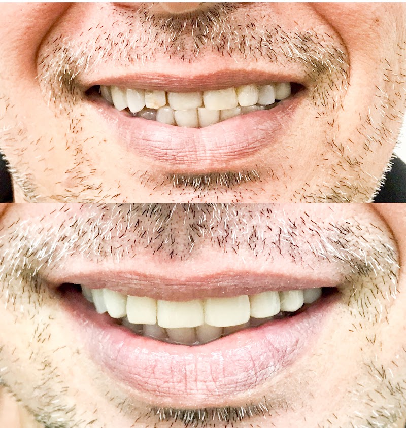 Dra. Analice Martins Ortodontia Invisalign - foto 5