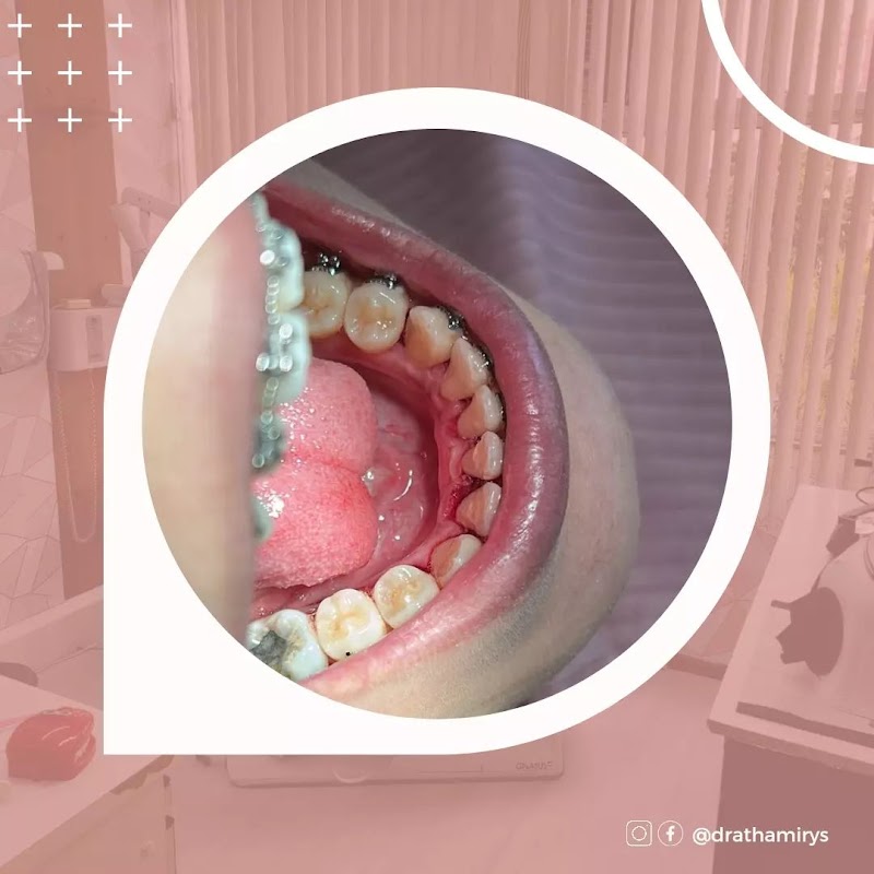 Dra Thamirys Lorena Oliveira - Cirurgiã Dentista e Odontopediatra Méier - foto 3