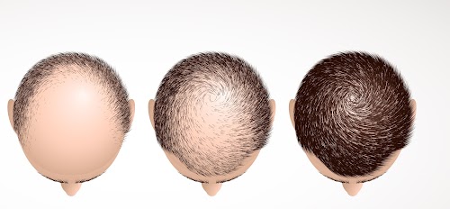 greffe cheveux tunisie logo