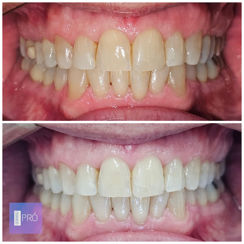 Espaço Sorriso Pró | Dentista | Menino Deus - Porto Alegre - foto 5