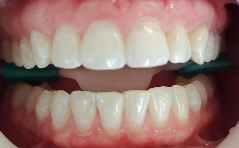 Clínica Odontológica Dra. Camila Melo | Dentista Águas Claras | Especialista em Odontopediatria - foto 5