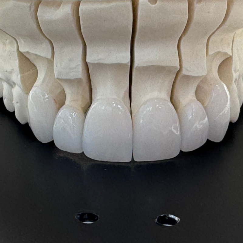 Dra. Carina Lyra - Dentista em Niterói - foto 4