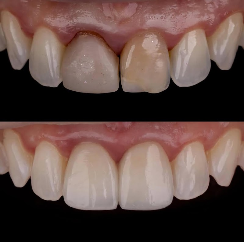 Ortoestética Boa Viagem Sul | Facetas | Implantes | Ortodontia | Invisalign | Harmonização - foto 2