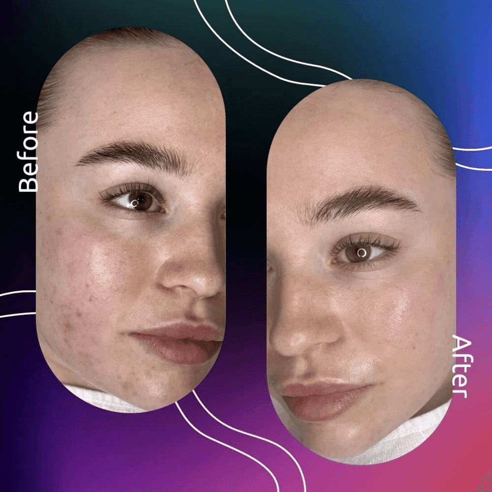 Novomed Lasers and Facials Clinic - Dubai Marina Laser Hair Removal | Hydrafacial | Carbon Peel 4