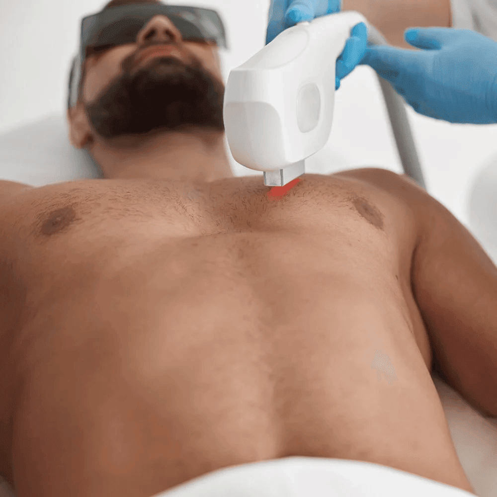 Novomed Lasers and Facials Clinic - Dubai Marina Laser Hair Removal | Hydrafacial | Carbon Peel 2