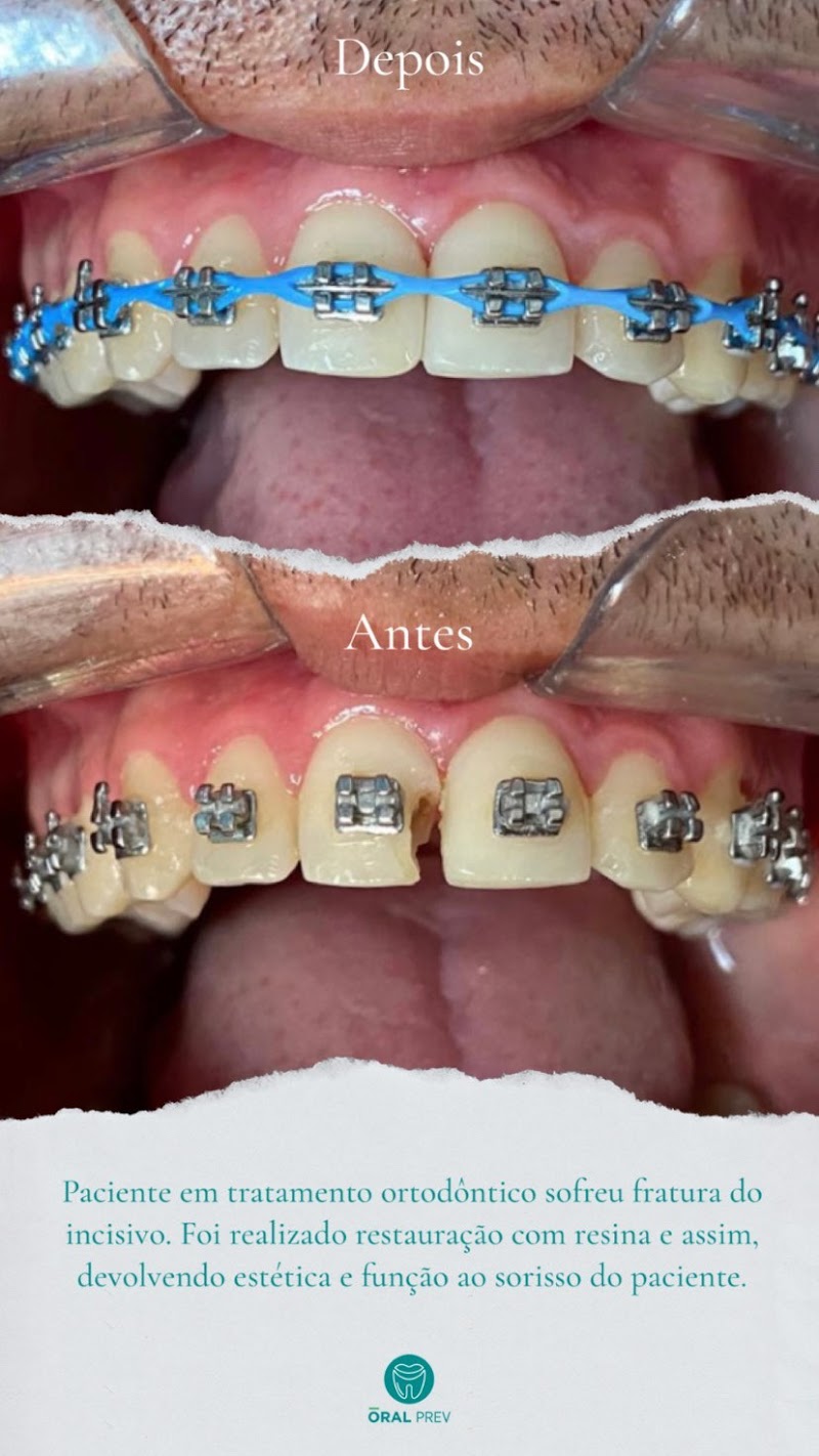 Unic Odontologia-Integrada | Dentistas especialistas em Implantes, Próteses, Ortodontia e Facetas em Natal-RN - foto 3