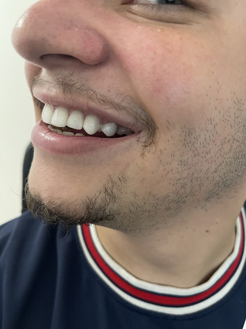 Dentista na Taquara Dra. Juliana França - Lentes de Resina - Preenchimento Labial - foto 5