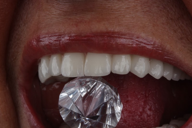 Precision Dental Studio - Dentista Salvador - BA - foto 3