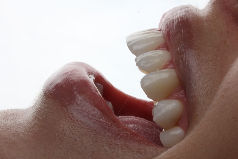 Precision Dental Studio - Dentista Salvador - BA